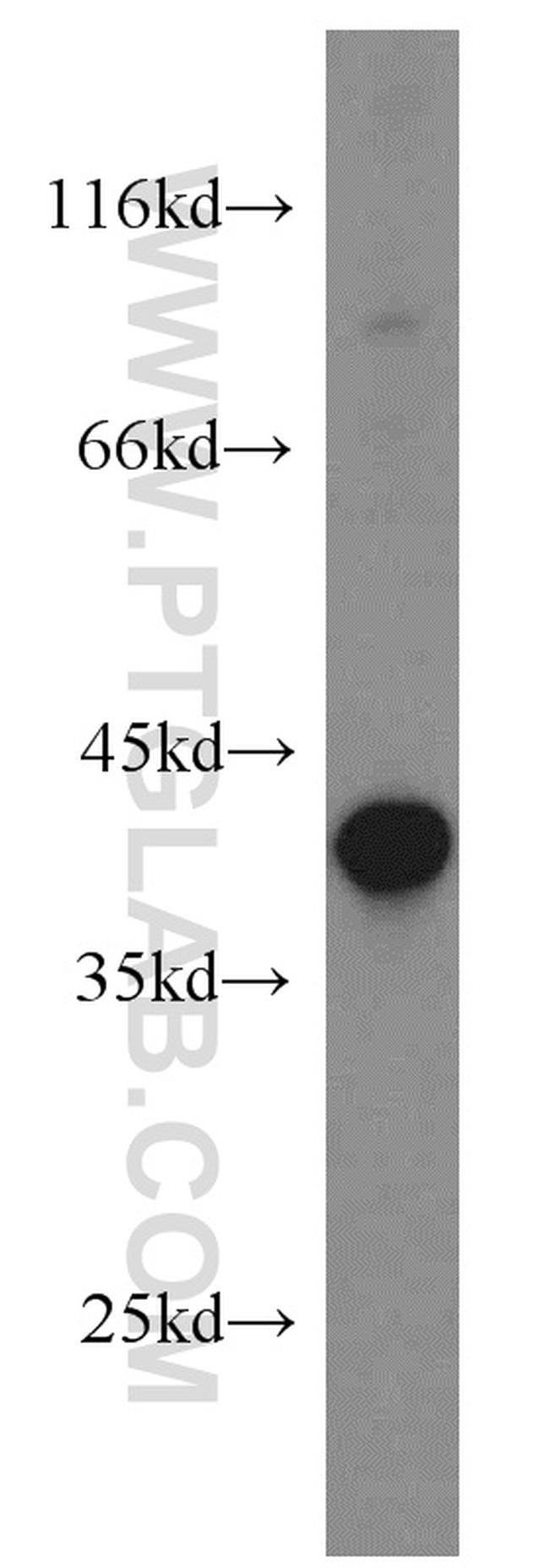 PIH1D1 Antibody in Western Blot (WB)