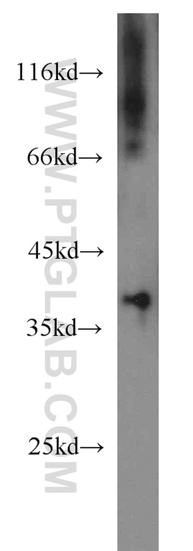 PIH1D1 Antibody in Western Blot (WB)