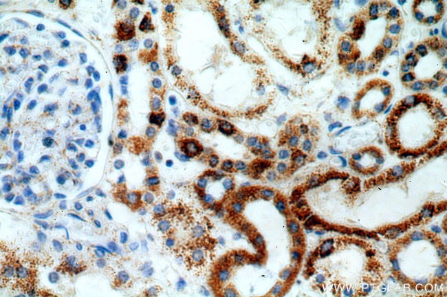 ZIP7 Antibody in Immunohistochemistry (Paraffin) (IHC (P))