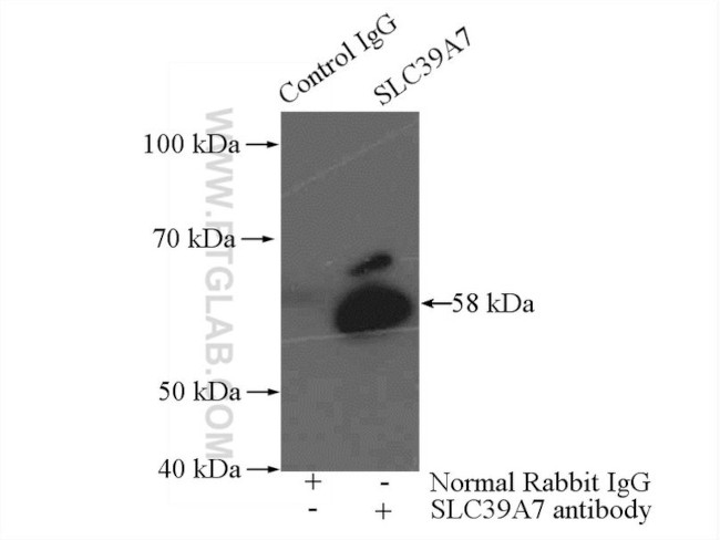 ZIP7 Antibody in Immunoprecipitation (IP)