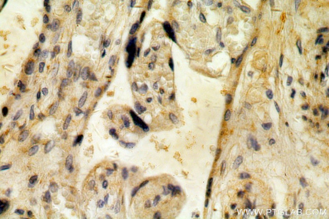 ZIP7 Antibody in Immunohistochemistry (Paraffin) (IHC (P))