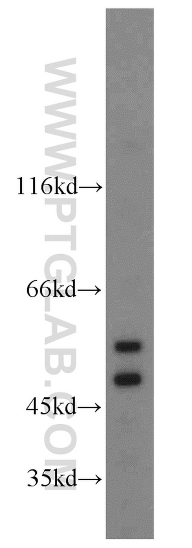 ZIP7 Antibody in Western Blot (WB)