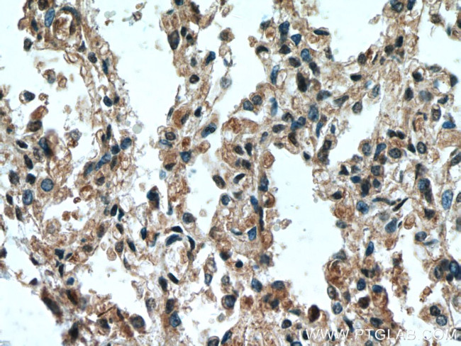 HUWE1 Antibody in Immunohistochemistry (Paraffin) (IHC (P))