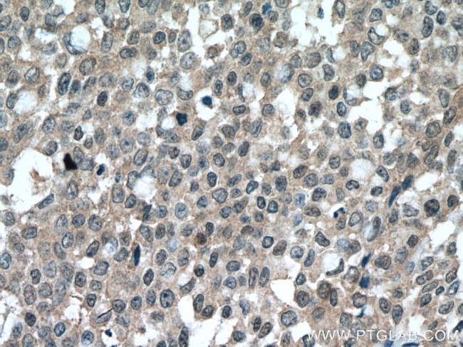 HUWE1 Antibody in Immunohistochemistry (Paraffin) (IHC (P))