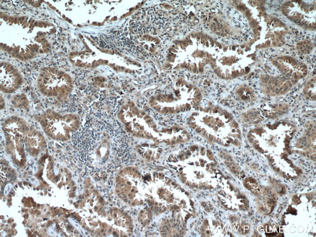 HUWE1 Antibody in Immunohistochemistry (Paraffin) (IHC (P))