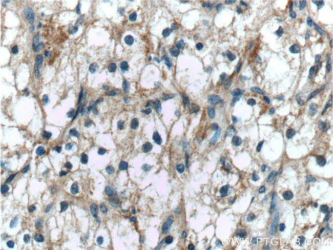 ALDH3B1 Antibody in Immunohistochemistry (Paraffin) (IHC (P))