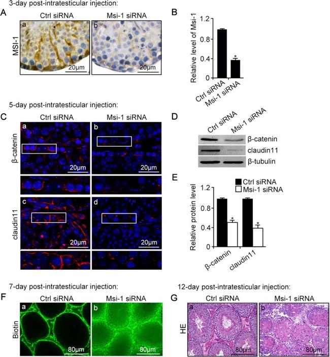 Claudin 11 Antibody in Immunohistochemistry (IHC)