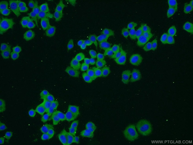 TRPC1 Antibody in Immunocytochemistry (ICC/IF)