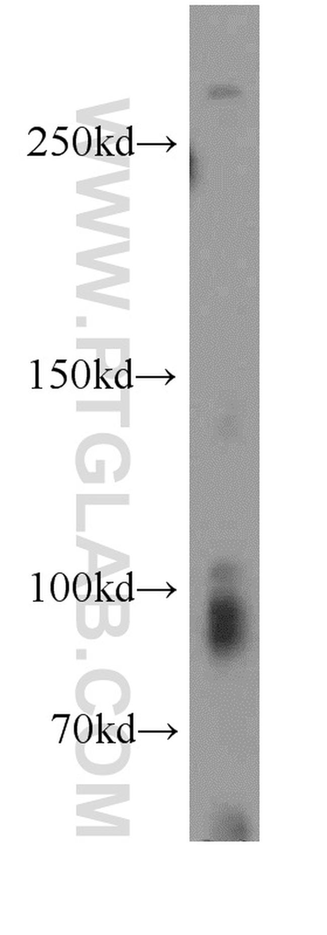 TRPC1 Antibody in Western Blot (WB)