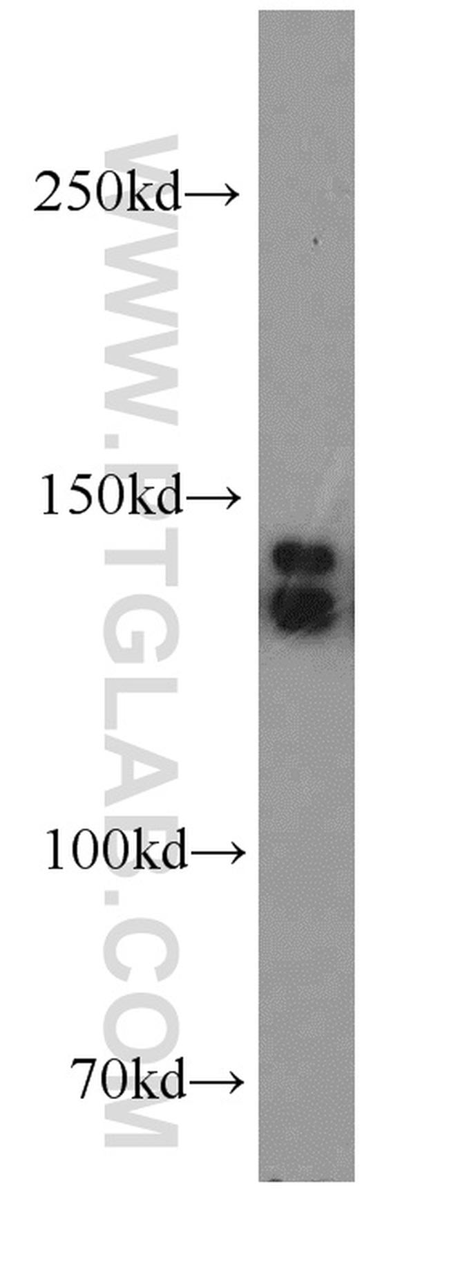 TRPC1 Antibody in Western Blot (WB)