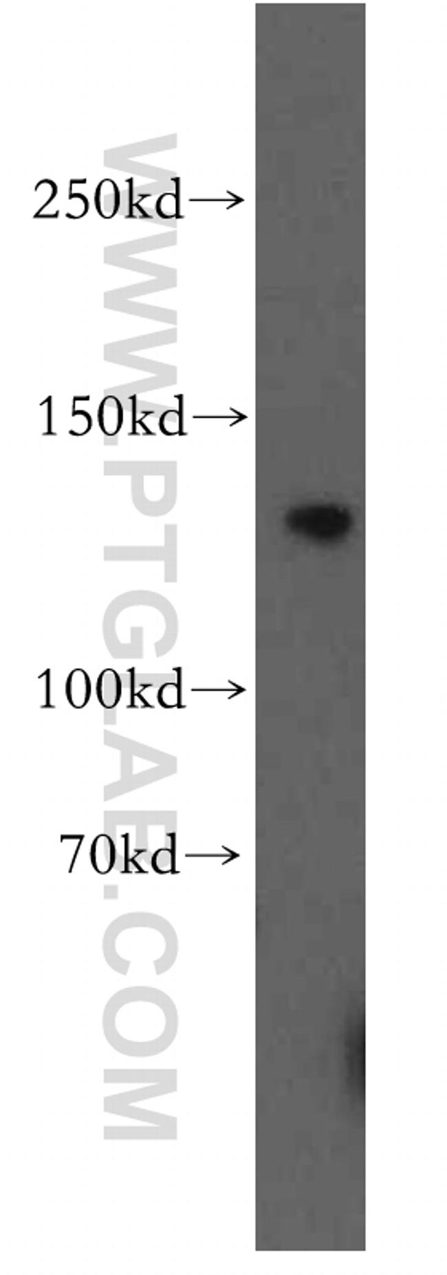 TRPC1 Antibody in Western Blot (WB)