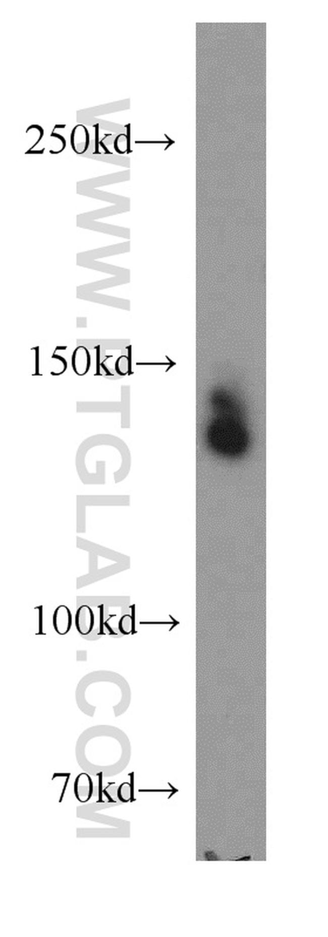 TRPC1 Antibody in Western Blot (WB)