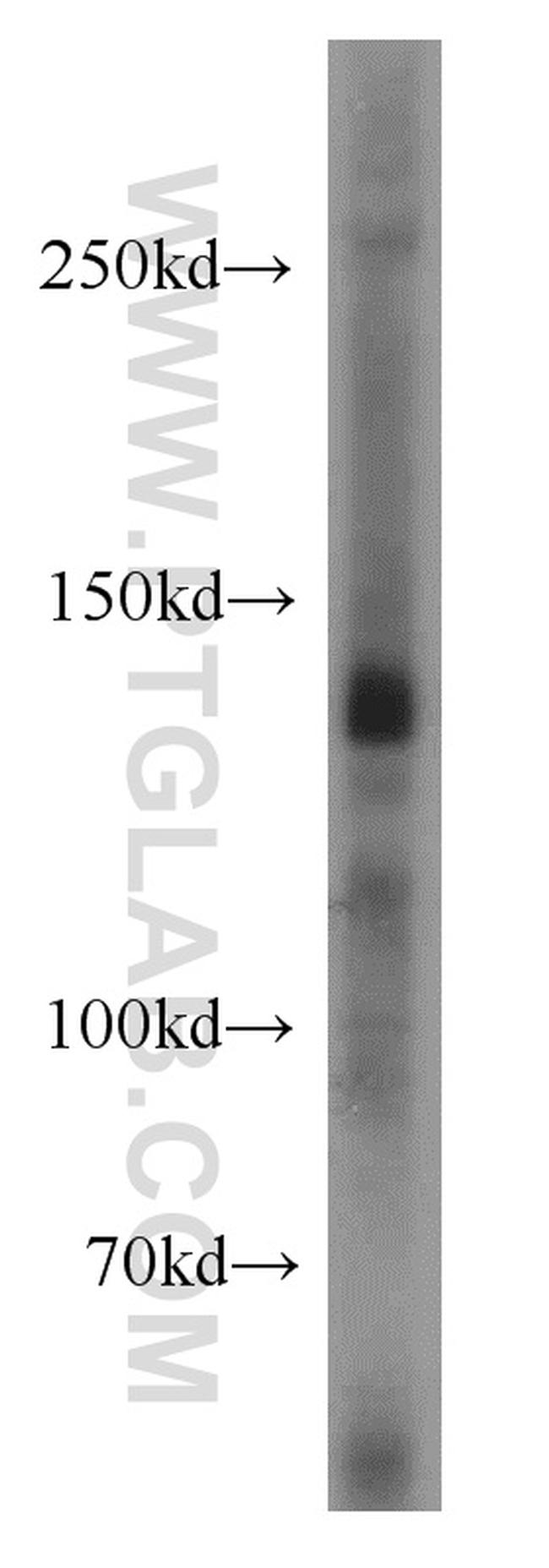 TRPC1 Antibody in Western Blot (WB)