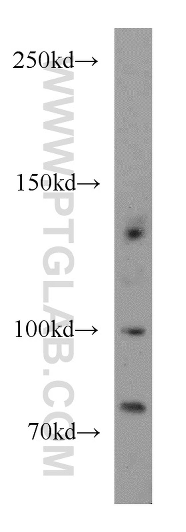 TRPC1 Antibody in Western Blot (WB)