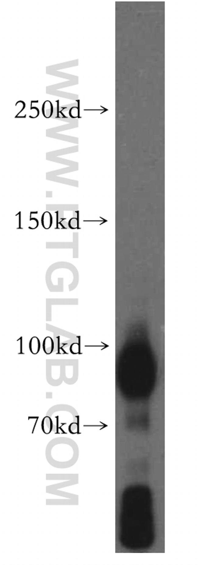 TRPC1 Antibody in Western Blot (WB)