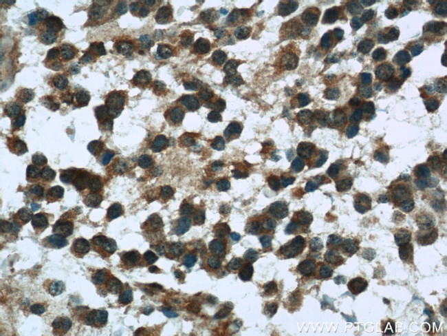 Nestin Antibody in Immunohistochemistry (Paraffin) (IHC (P))