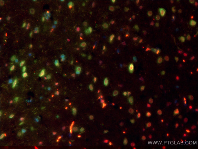 Nestin Antibody in Immunohistochemistry (PFA fixed) (IHC (PFA))