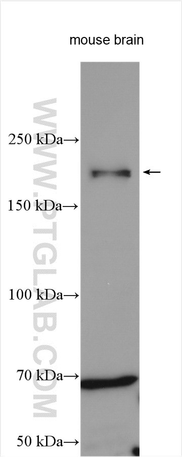 Nestin Antibody in Western Blot (WB)