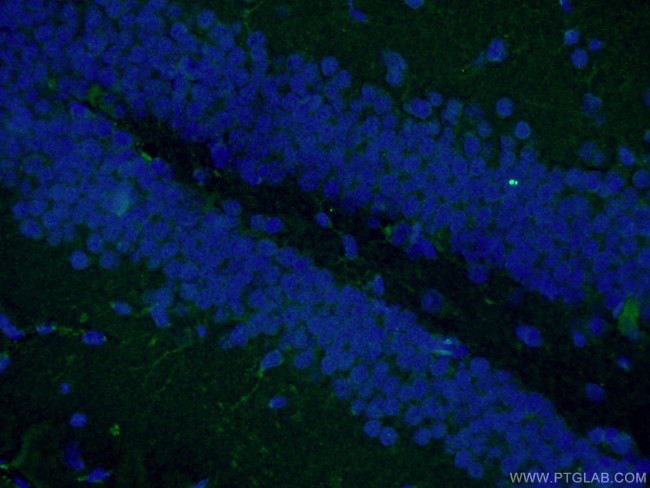 Nestin Antibody in Immunohistochemistry (PFA fixed) (IHC (PFA))