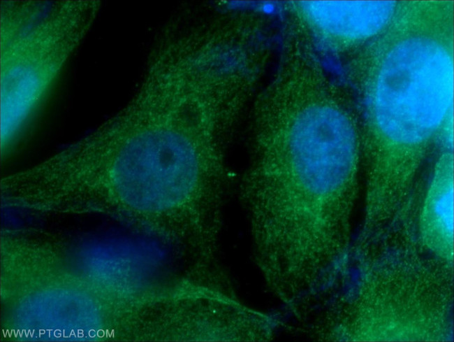 Nestin Antibody in Immunocytochemistry (ICC/IF)