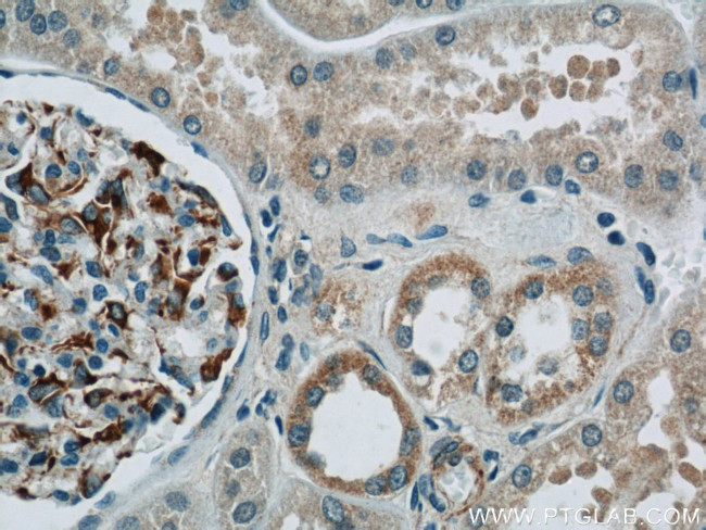 Nestin Antibody in Immunohistochemistry (Paraffin) (IHC (P))