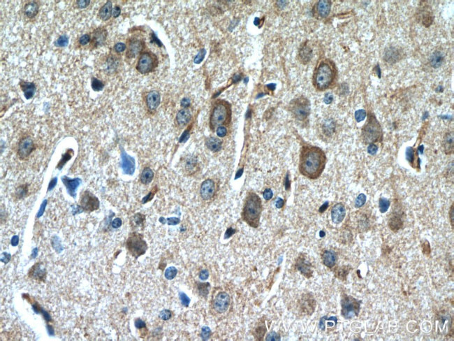 Nestin Antibody in Immunohistochemistry (Paraffin) (IHC (P))