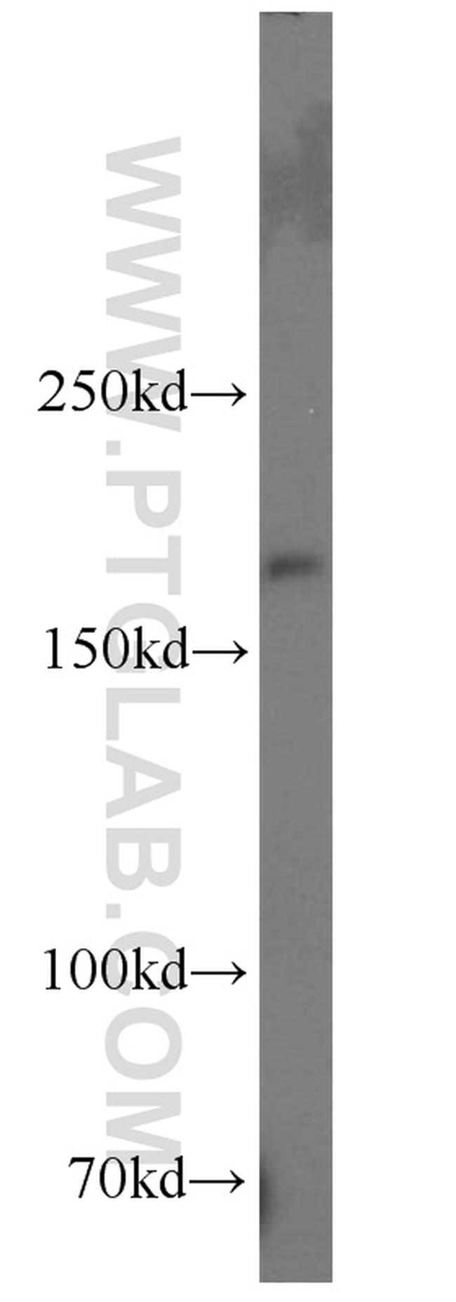 Nestin Antibody in Western Blot (WB)