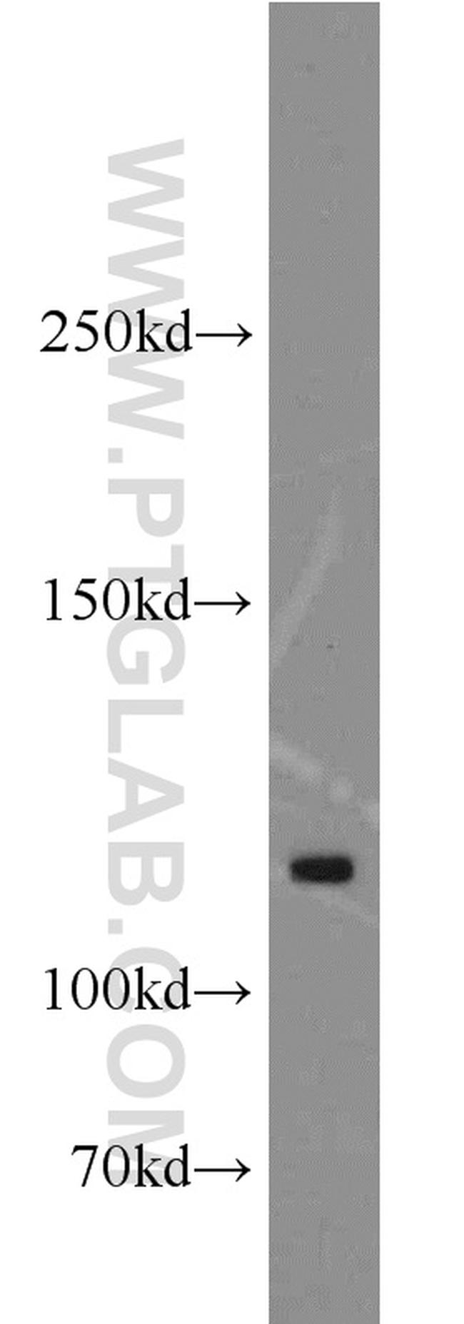 ANO3 Antibody in Western Blot (WB)