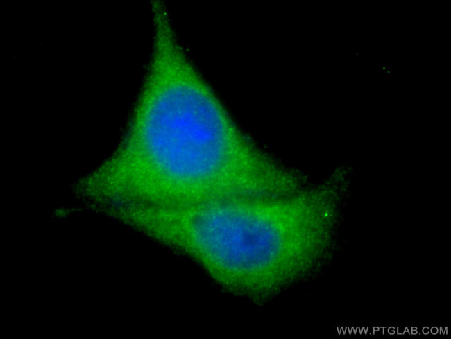 ATG14/Barkor (N-terminal) Antibody in Immunocytochemistry (ICC/IF)