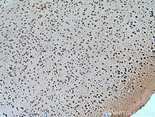 ATG14/Barkor (N-terminal) Antibody in Immunohistochemistry (Paraffin) (IHC (P))