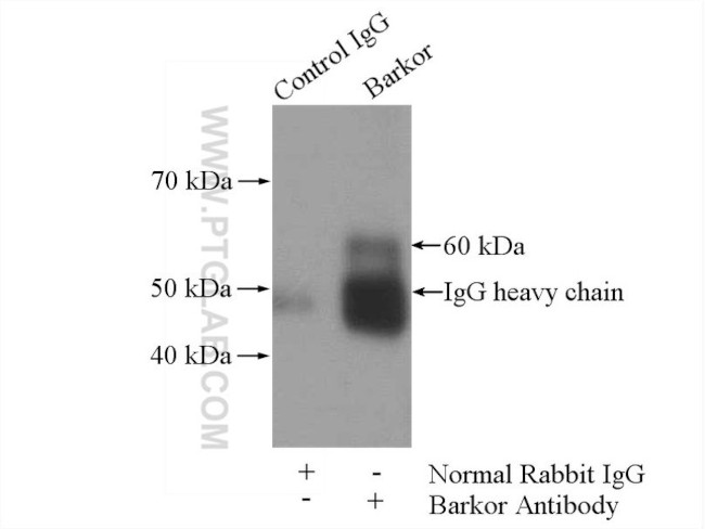 ATG14/Barkor (N-terminal) Antibody in Immunoprecipitation (IP)