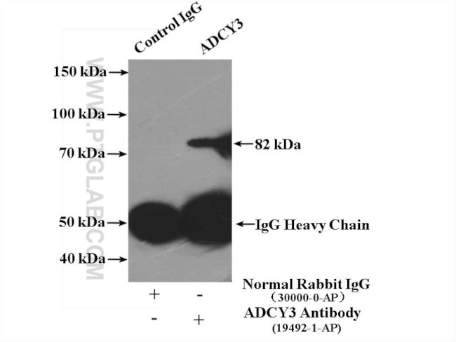 ADCY3 Antibody in Immunoprecipitation (IP)