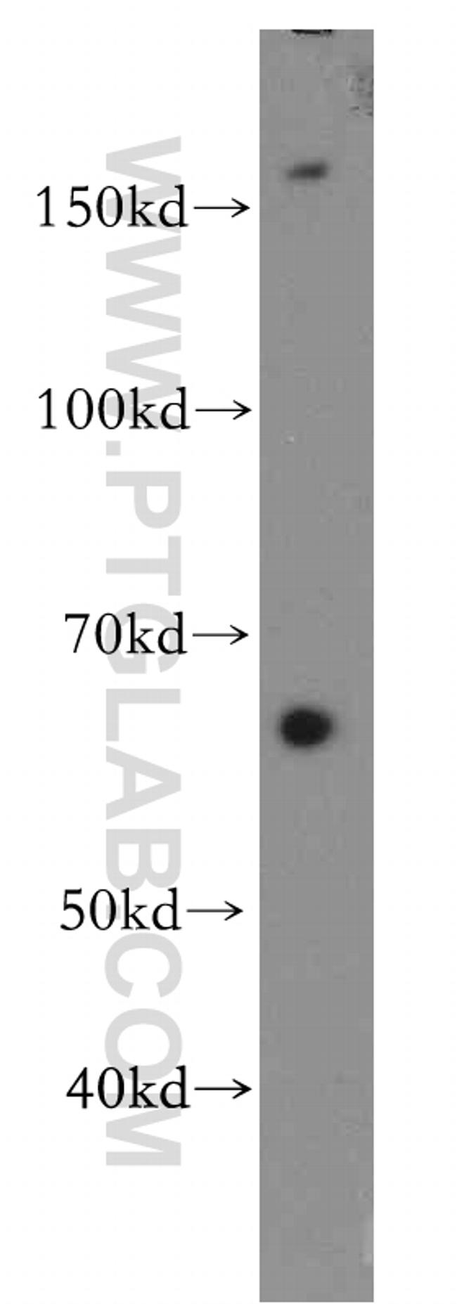 VLDLR Antibody in Western Blot (WB)