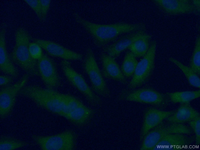 AFM Antibody in Immunocytochemistry (ICC/IF)