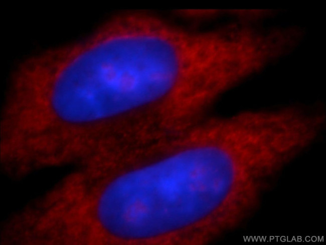 Aldehyde oxidase Antibody in Immunocytochemistry (ICC/IF)