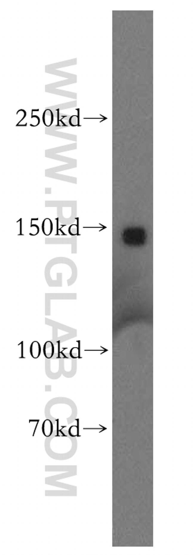 Aldehyde oxidase Antibody in Western Blot (WB)