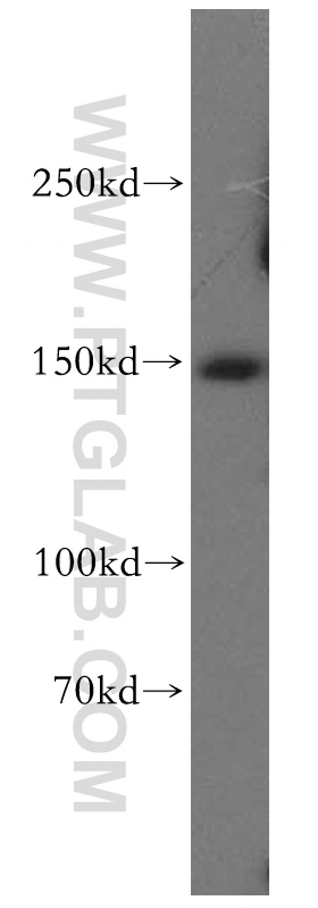 Aldehyde oxidase Antibody in Western Blot (WB)