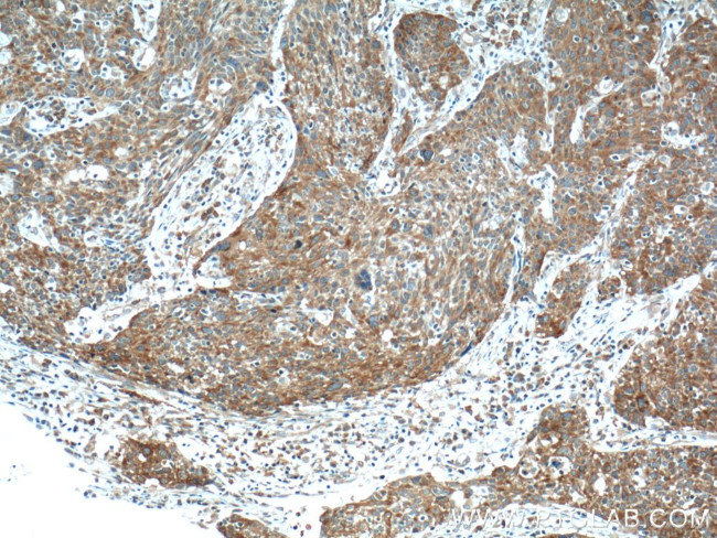 FUT4 Antibody in Immunohistochemistry (Paraffin) (IHC (P))