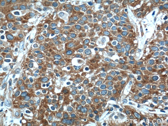 FUT4 Antibody in Immunohistochemistry (Paraffin) (IHC (P))