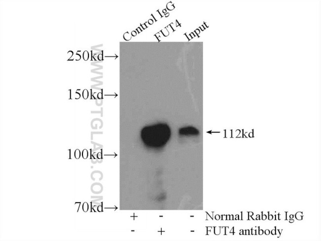 FUT4 Antibody in Immunoprecipitation (IP)