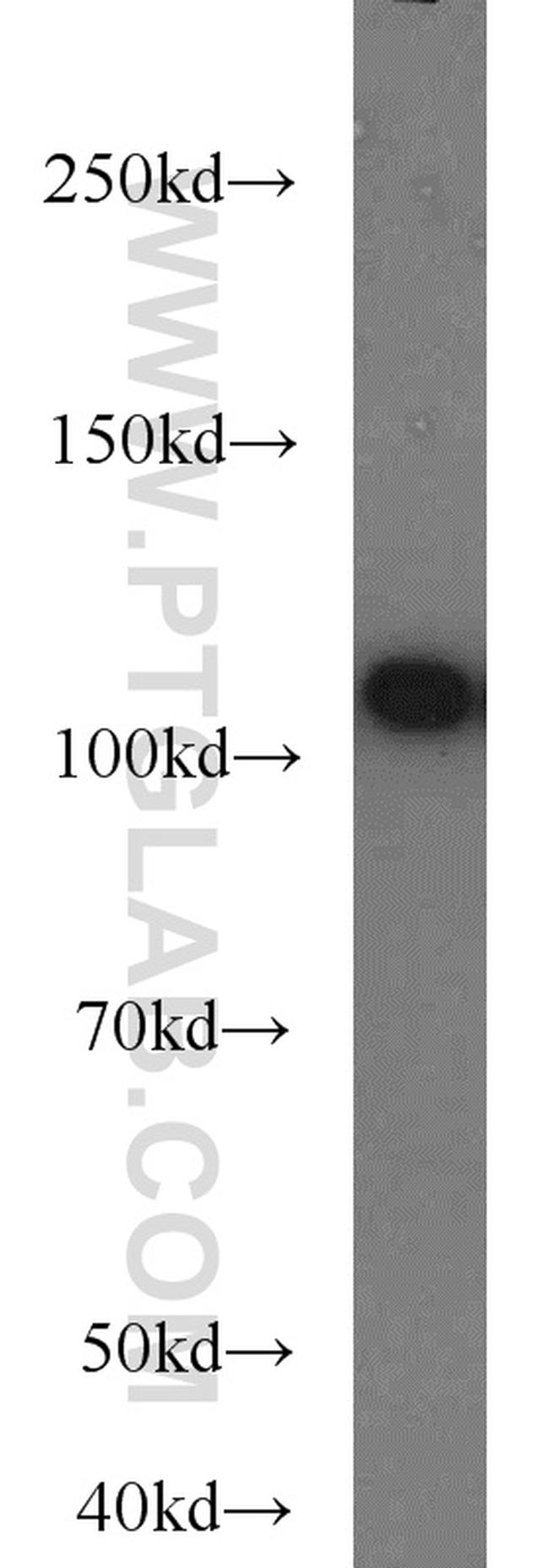 FUT4 Antibody in Western Blot (WB)