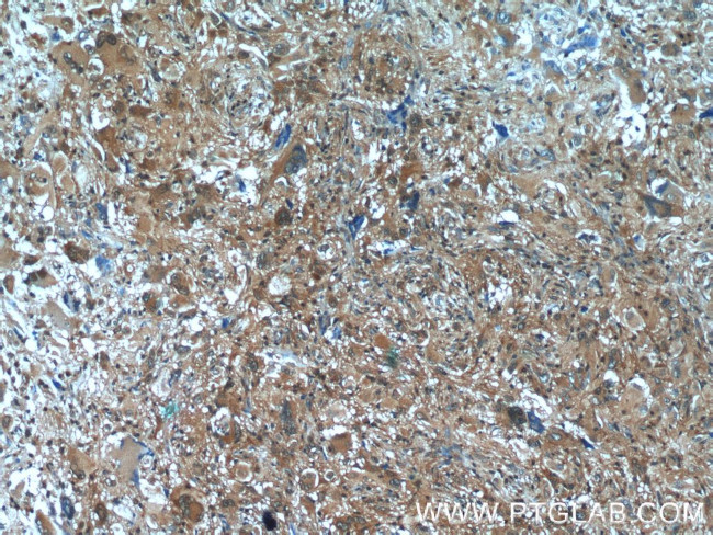 FUT4 Antibody in Immunohistochemistry (Paraffin) (IHC (P))