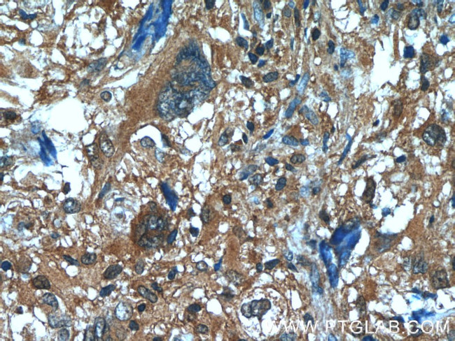 FUT4 Antibody in Immunohistochemistry (Paraffin) (IHC (P))