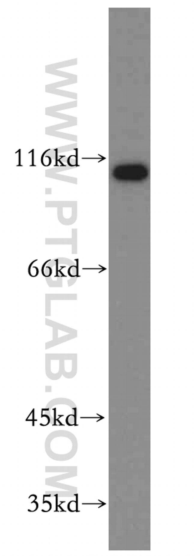 FUT4 Antibody in Western Blot (WB)