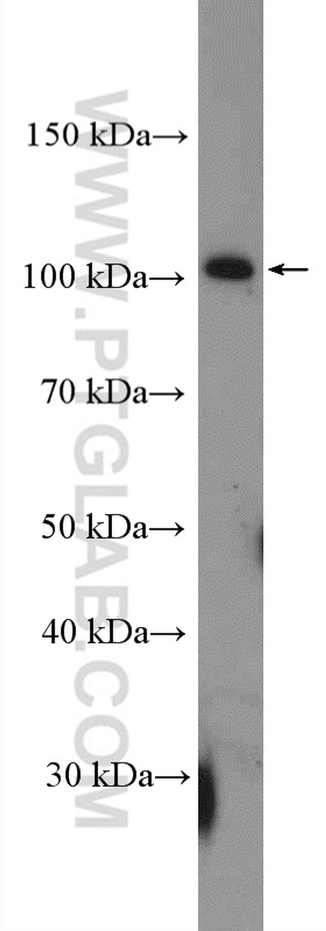 FUT4 Antibody in Western Blot (WB)