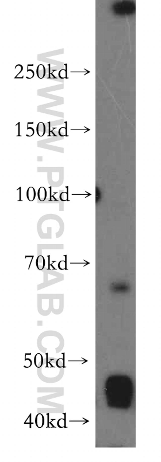 LRMP Antibody in Western Blot (WB)