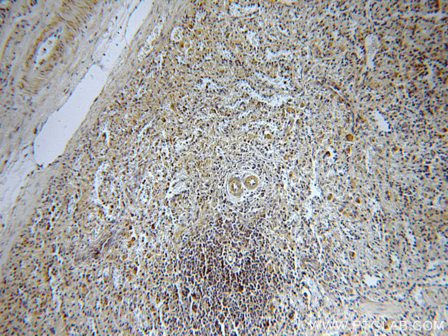 LRMP Antibody in Immunohistochemistry (Paraffin) (IHC (P))