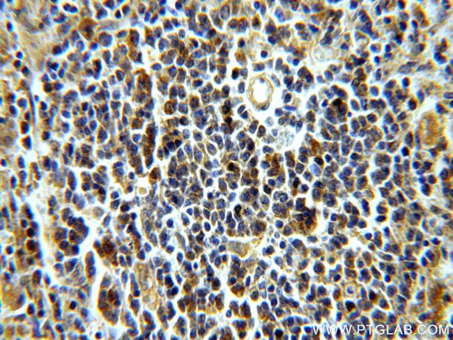 LRMP Antibody in Immunohistochemistry (Paraffin) (IHC (P))