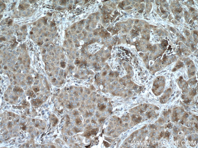 SULT1A3 Antibody in Immunohistochemistry (Paraffin) (IHC (P))