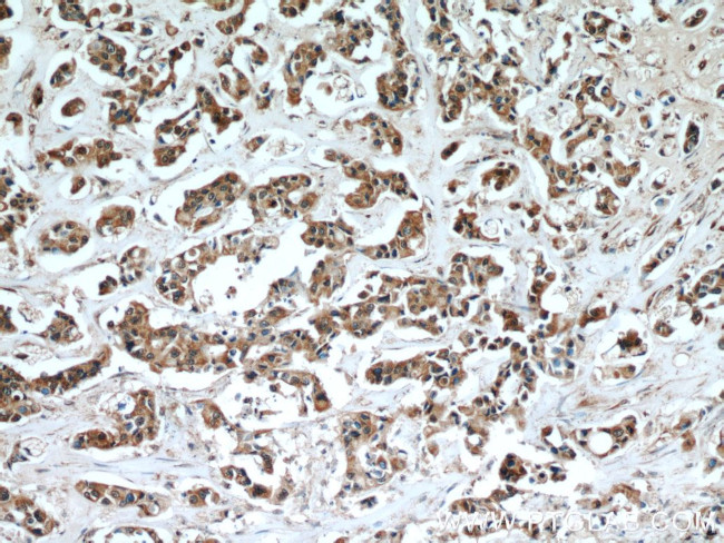 SULT1A3 Antibody in Immunohistochemistry (Paraffin) (IHC (P))